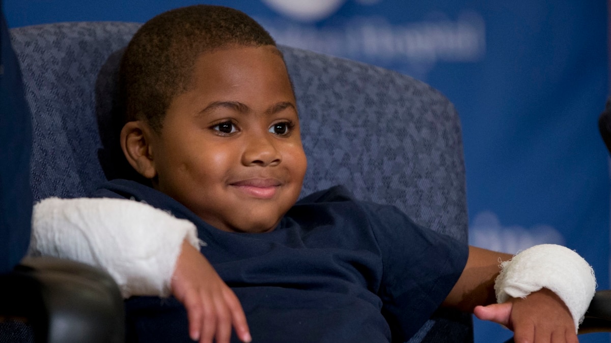 american-boy-is-world-s-youngest-person-to-get-double-hand-transplant