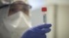 В США выявлен первый случай «бразильского» штамма коронавируса 