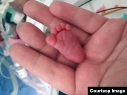FILE: Baby Emilia's foot measured 3.1 centimetres in the birth. The baby was born in Germany and said to be the smallest ever born in the world who survived a premature birth.