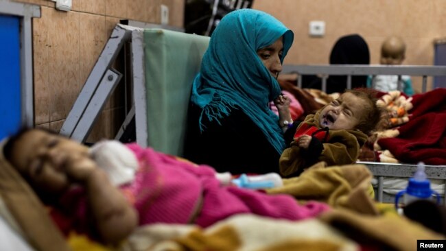 FILE: A mother holds her one-year-old baby, at the malnutrition ward for infants of Indira Gandhi Children's hospital in Kabul, Afghanistan, Oct. 23, 2021.