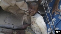 یکی از کودکانی نایجریایی که در نتیجۀ حملۀ جت نظامیان بر کمپ بیجا شدگا منطقۀ "ران" آن کشور، زخمی شده است
