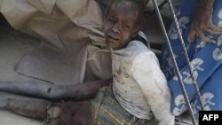 This handout image received courtesy of Doctors Without Border (MSF), Jan. 17, 2017, shows a wounded child after an air force jet accidentally bombarded a camp for those displaced by Boko Haram Islamists, in Rann, northeast Nigeria.