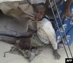 A Doctors Without Border (MSF) handout photo distributed Jan. 17, 2017, shows a wounded child after following the bombing by a Nigerian Air Force jet of a camp for those displaced by Boko Haram Islamists, in Rann, northeast Nigeria.