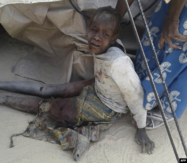 A Doctors Without Border (MSF) handout photo distributed Jan. 17, 2017, shows a wounded child after following the bombing by a Nigerian Air Force jet of a camp for those displaced by Boko Haram Islamists, in Rann, northeast Nigeria.