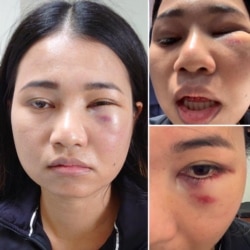 Mantakarn, a Thai-American woman who was assaulted while riding the BART train in San Francisco, CA. (Credit: Dion Lim)