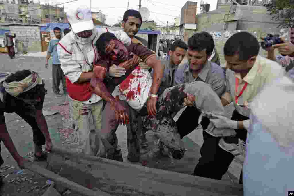 September 19, 2011: Yemeni Anti-government protestors carry Hassan Wadaf, a cameraman wounded in clashes with security forces. Several people were killed in recent days as snipers picked off protesters from rooftops&nbsp; in Sanaa.