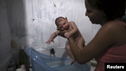 지난 9일 브라질 레시페 시에서 한 여성이 소두증으로 태어나 2월된 아들을 목욕시키고 있다.