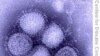 国际机构呼吁帮助贫困国家对抗甲型H1N1流感