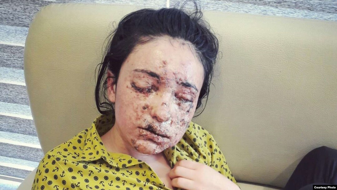 Lamiya Hachi Bashar laying on a couch while waiting for treatment, May 2, 2016. (Photo courtesy of Bashar’s uncle Idris Kojo) 