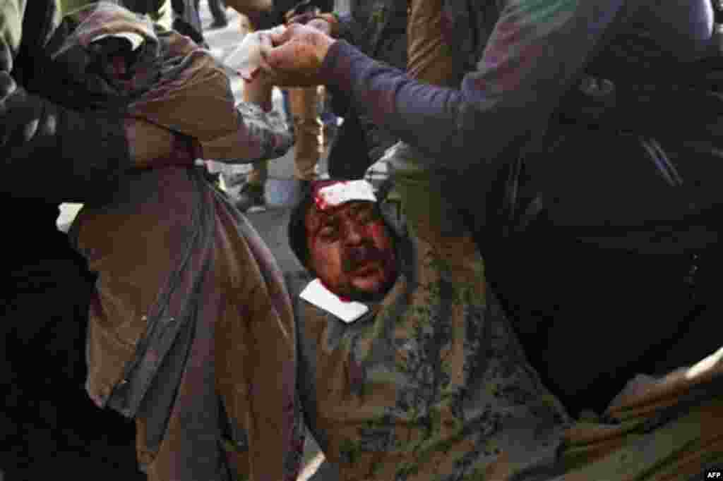 An injured anti-government protester is carried away from clashes in Tahrir, or Liberation square, in Cairo, Egypt, Wednesday, Feb. 2, 2011. Several thousand supporters of President Hosni Mubarak, including some riding horses and camels and wielding whips