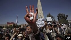 خۆپـیشـانده‌رێـکی یه‌مه‌نی دژه‌ حکومه‌ت له‌ سه‌نعای پایته‌خت ده‌سـتی خۆی نیشـانی میدیاکان ده‌کات که‌ چۆن برینداریان کردووه‌، شه‌ممه‌ 19 ی دووی 2011