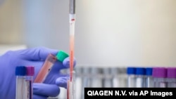 A QuantiFERON-TB blood test. Data published in The Lancet Respiratory Medicine journal shows screening with QuantiFERON