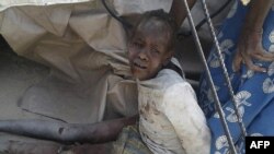 Gambar yang dirilis oleh Doctors Without Border (MSF), ini menampilkan seorang anak yang terluka akibat serangan udara militer Nigeria di wilayah Rann, 17 Januari 2017. (AFP PHOTO/Médecins sans Frontières (MSF) ) 