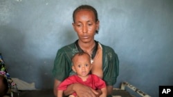 Lete Yohannes, 34, holds her baby Temesgen Muluhaw, 8 months old, who is suffering from malnutrition, at the Finarwa Health Center in Mai Mekden, in the Tigray region of northern Ethiopia, on Feb. 27, 2024. 