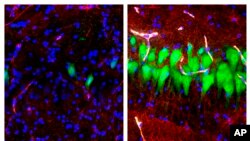 This images show stained microscope photos of neurons, green; astrocytes, red, and cell nuclei, blue, from a pig brain left untreated for 10 hours after death, left, and another with a specially designed blood substitute pumped through it. (Yale School of Medicine)