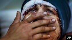 n this March 10, 2012 file photo, Aida cries as she recovers from severe injuries after the Syrian Army shelled her house in Idlib, north Syria. Aida's husband and two of her children were killed after their h