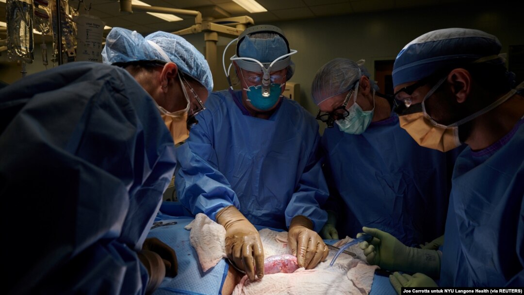 Tim bedah memeriksa ginjal babi di NYU Langone di New York, AS. (Foto: Joe Carrotta for NYU Langone Health via Reuters) 