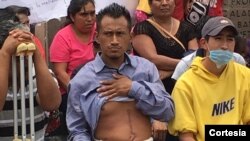 Las víctimas del enfrentamiento con la policía federal y estatal en Nochixtlán, en Oaxaca, México pidieron garantías ante la Comisión Interamericana de Derechos Humanos mientras luchan porque se haga justicia sobre su caso.