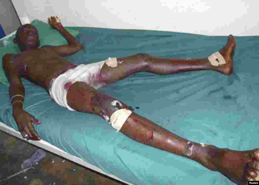 A bystander injured in a bomb blast in front of the Kaduna office compound of Nigerian newspaper This Day lies on a hospital bed in the northern city of Kaduna April 26, 2012.