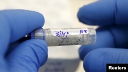 FILE - A health technician at the National Institute of Health in Lima, Peru, analyzes a blood sample from a patient bitten by a mosquito, Feb. 2, 2016.