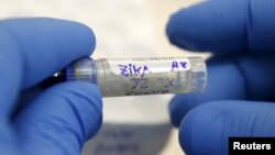 FILE - A health technician analyzes a blood sample from a patient bitten by a mosquito. On August 2, the U.S. began the first clinical trial of an experimental Zika vaccine.