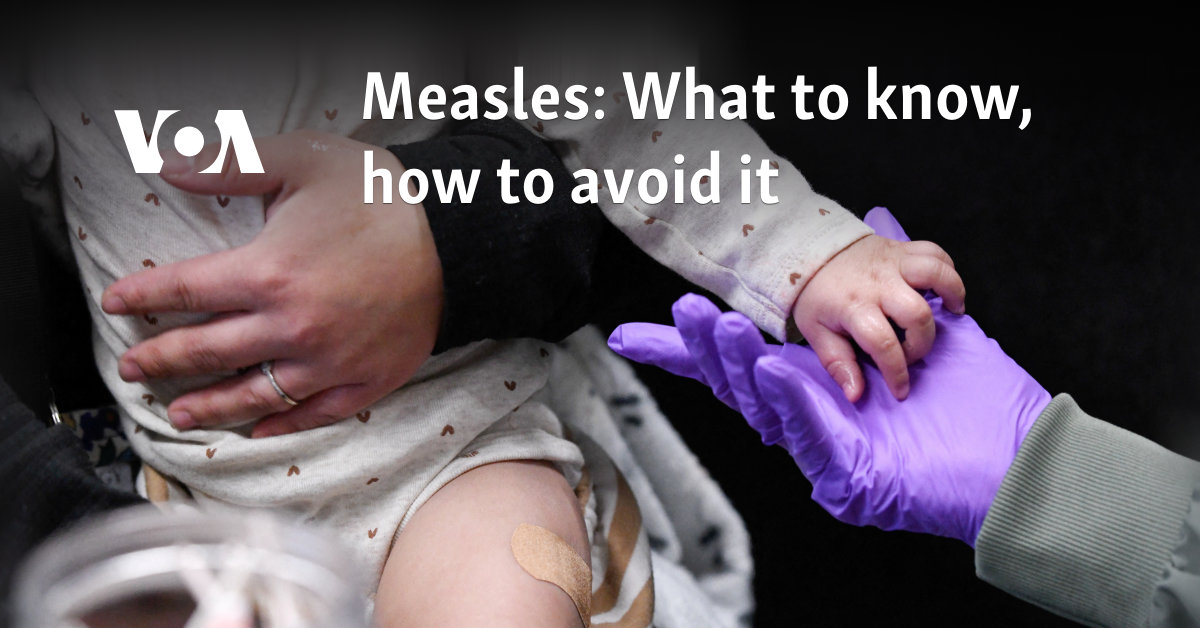 Measles: What to know, how to avoid it