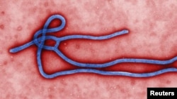 FILE - This undated file image made available by the CDC shows the Ebola Virus.