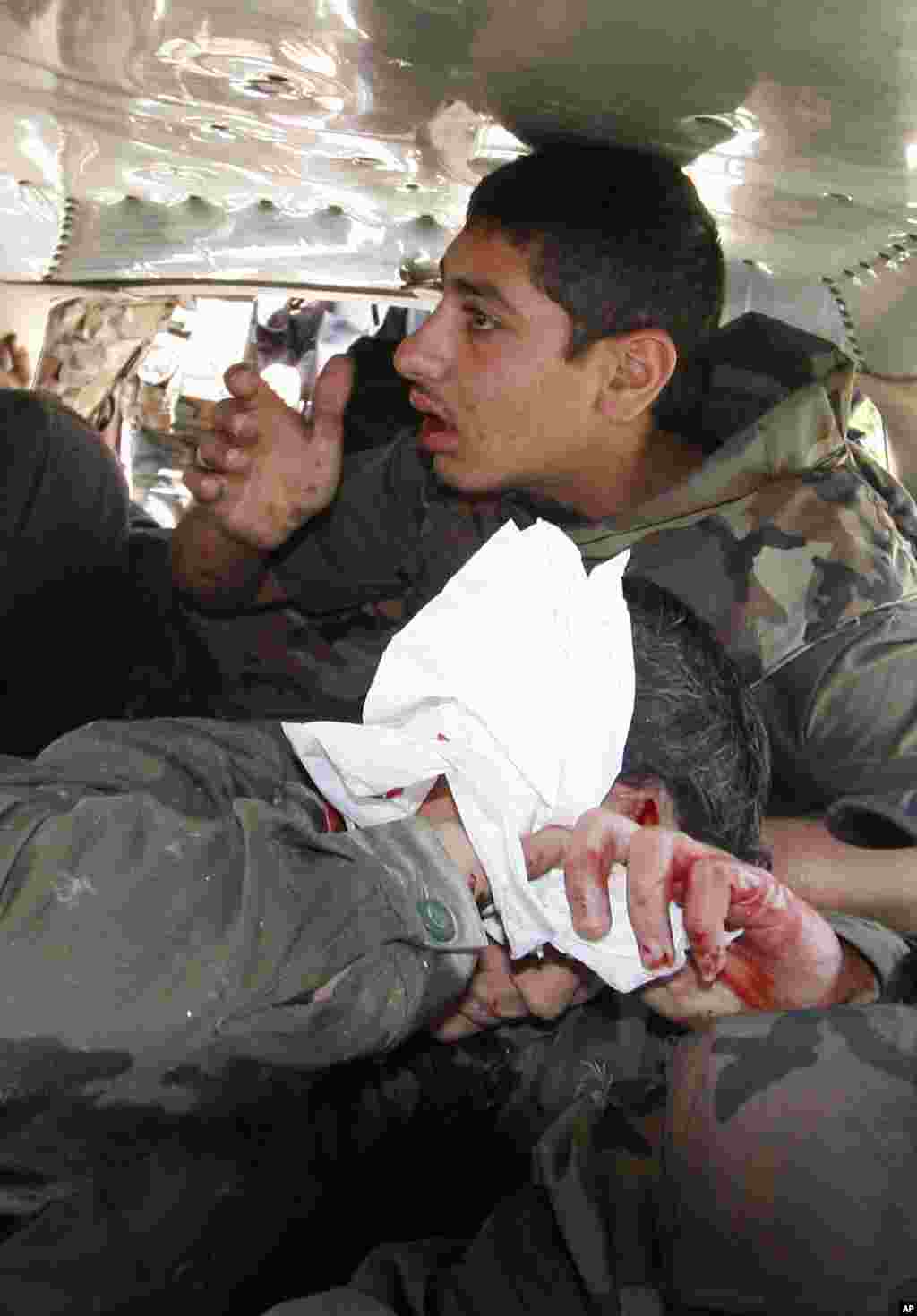 An injured Syrian army soldier, who was hurt when a roadside bomb hit his military truck, covers his wound with a bandage as he is helped by his comrade to a hospital.