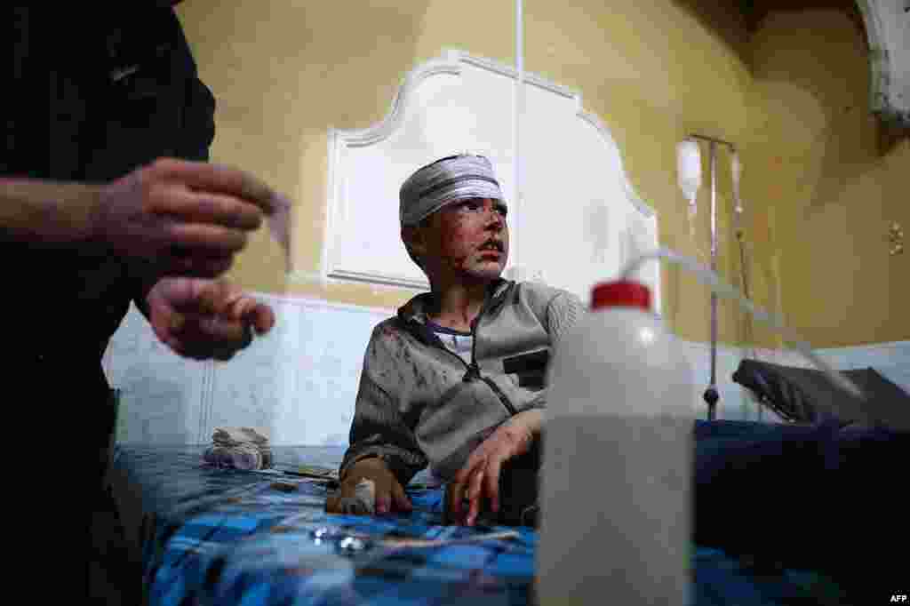 A wounded Syrian boy receives treatment at a make-shift hospital following reported government shelling on the rebel-held town of Douma, east of the Syrian capital Damascus.