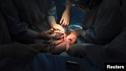 FILE - A doctor cuts the umbilical cord of a newborn baby.