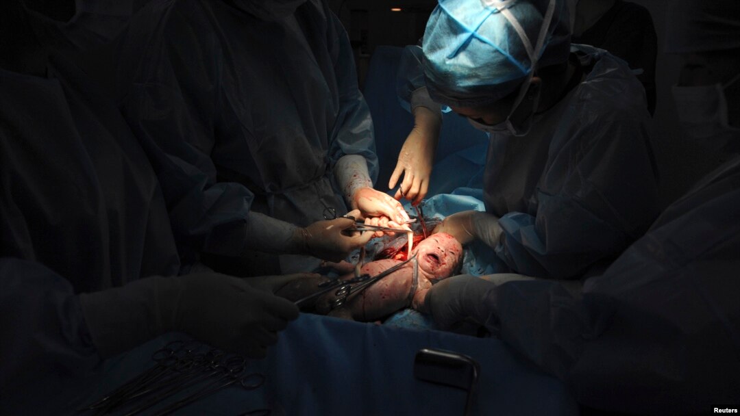 Seorang dokter memotong tali pusar bayi yang baru lahir selama operasi caesar di sebuah rumah sakit di daerah Shaya, Daerah Otonomi Xinjiang Uighur, 4 Juni 2012. (Foto: Reuters)