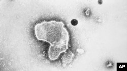 ARCHIVO - Foto de 1981 de los Centros para el Control y Prevención de Enfermedades de EEUU muestra una imagen de microscopio electrónico del virus RSV.