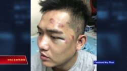 Quốc tế kêu gọi điều tra vụ bố ráp đêm nhạc Nguyễn Tín