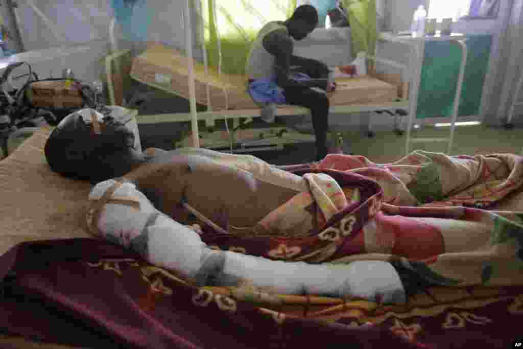 An unidentified victim of Tuesday's car bomb explosions receives treatment in Jos University Teaching Hospital in Jos, Nigeria, May 21, 2014.