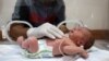 A baby was reportedly delivered by Cesarean section after his pregnant mother was killed in an overnight Israeli strike on Nuseirat in the central Gaza Strip. He is caressed by his grandfather as he lies in an incubator at the Al-Awda Hospital in Deir el-Balah on July 20, 2024.