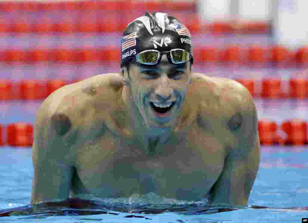 Michael Phelps a des traces sur ses épaules dûes à une technique de récupération pratiquée avec des verres ventousés sur la peau, à Rio de Janeiro, Brésil, le 9 août 2016.