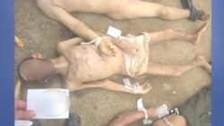 Syrian Defector Leaks Shocking Photos of Torture Victims