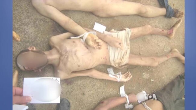 Syrian Defector Leaks Shocking Photos of Torture Victims