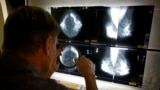 Mammograms Cuts