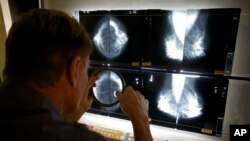 Ilustrasi - Direktur Medis Ahli Radiologi, Dr. Gerald Iba, memeriksa hasil rontgen mammogram untuk deteksi dini kanker payudara, di Pusat Deteksi Kanker Elizabeth di Los Angeles, 6 Oktober 2010. (AP/Damian Dovarganes)