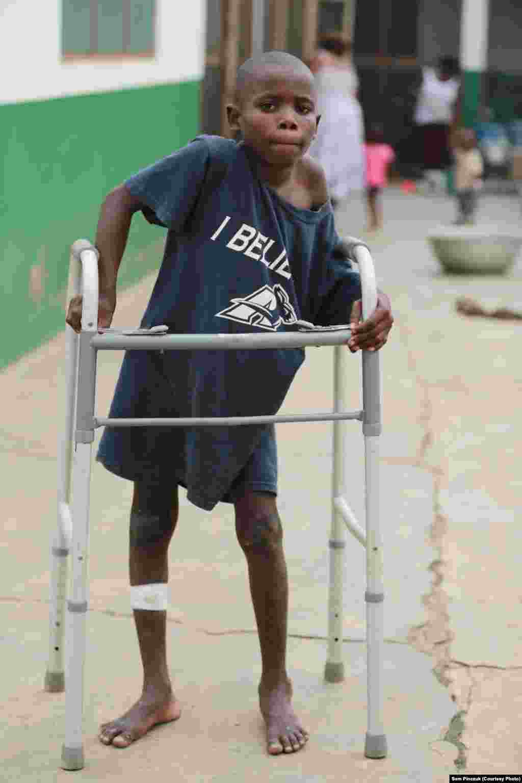 This boy was beaten so badly by a fisherman that he can no longer walk without the assistance of a walker.