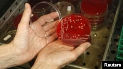 An employee displays MRSA bacteria strain - a drug-resistant 'superbug' - inside a petri dish containing agar jelly for bacterial culture in a microbiological laboratory in Berlin, March 1, 2008.