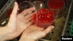 A technician displays MRSA bacteria strain - a drug-resistant "superbug" at a laboratory in Berlin.