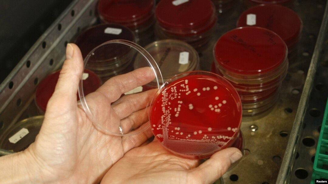 FILE - An employee displays MRSA bacteria strain - a drug-resistant 'superbug' - inside a petri dish containing agar jelly for bacterial culture in a microbiological laboratory in Berlin, March 1, 2008.