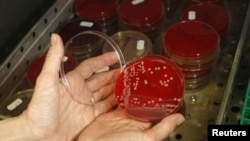 FILE - An employee displays a drug-resistant superbug inside a petri dish containing agar jelly for bacterial culture in a microbiological laboratory in Berlin, March 1, 2008.