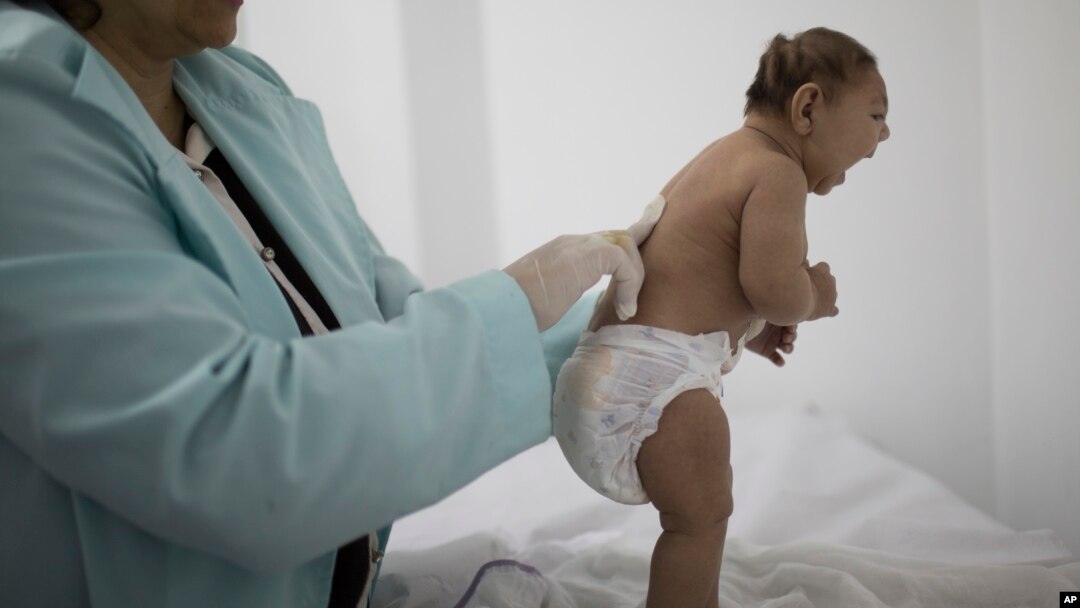 Zika mikrosefaliya bilan bog’liq ko’riladi. Bunda chaqaloqlar kichik miya bilan tug’iladi va rivojlanishdan orqada qoladi.