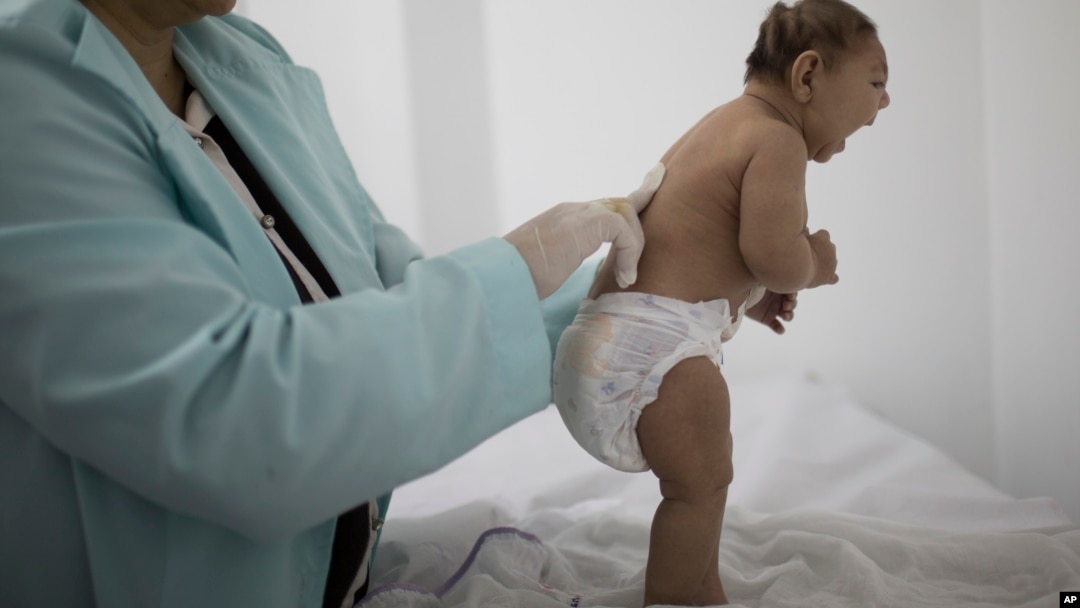 Un estudio reciente encontró que el virus del Zika ha sido hallado en los cerebros de los bebés afectados.