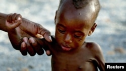 FILE - A mother holds onto her emaciated infant at an emergency feeding clinic in Maradi, Niger.