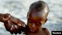 FILE - A mother holds onto her emaciated infant at an emergency feeding clinic in Maradi, Niger.