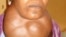 Goiter